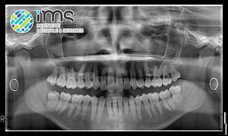 Panoramique / Conebeam OWANDY iMAX3D, système ouvert avec les caméras d'empreinte optique (MEDIT i700, etc.) et les imprimantes 3D.