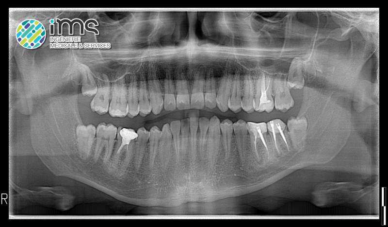 Panoramique / Conebeam OWANDY iMAX3D, système ouvert avec les caméras d'empreinte optique (MEDIT i700, etc.) et les imprimantes 3D.
