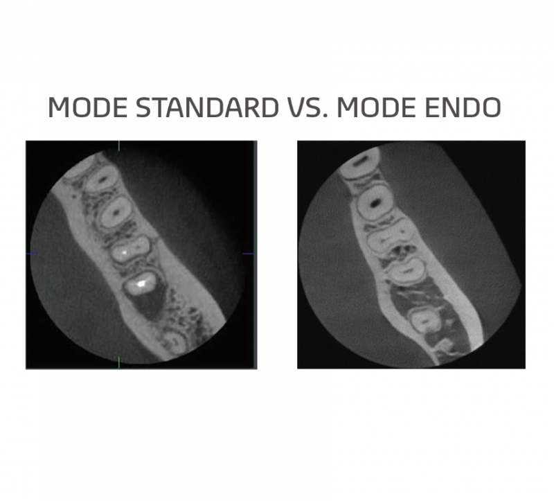 Conebeam VATECH Green X