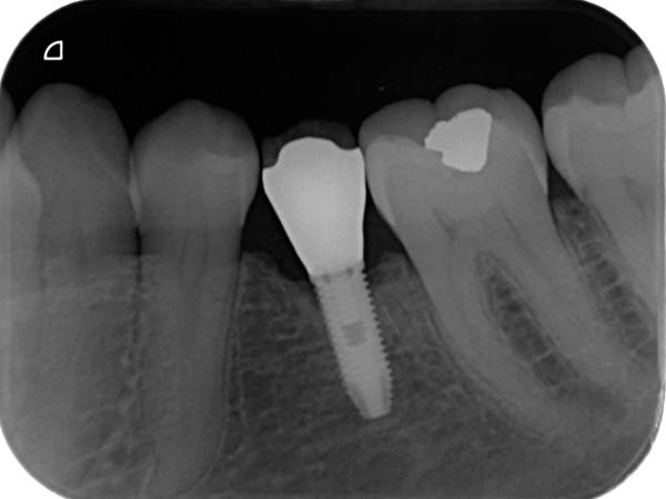Scanner radiologique DURR DENTAL VISTASCAN Mini Easy
