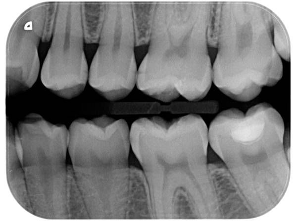 Scanner radiologique DURR DENTAL VISTASCAN Mini Easy