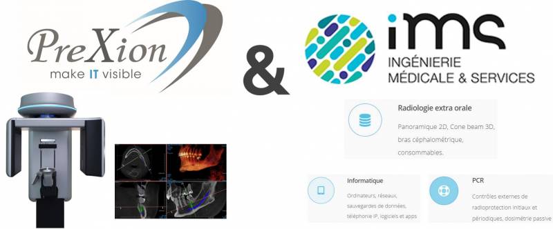 IMS devient distributeur des conebeam PREXION 3D Explorer PX1