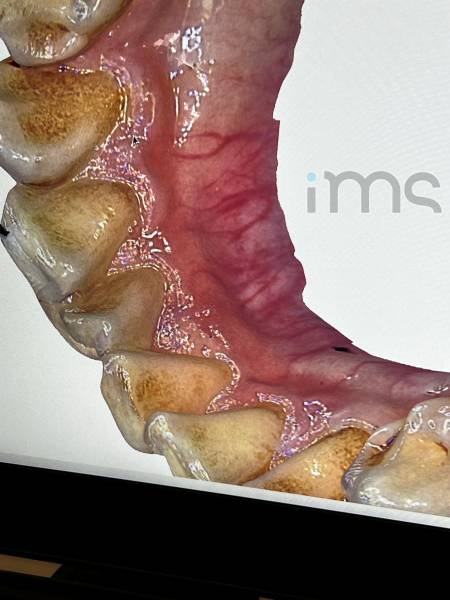Scanner intraoral BIOTECH WoW, images en couleurs réelles !
