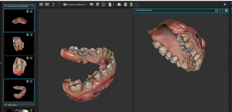 Import fichiers STL / PLY MEDIT dans l'application DURR DENTAL Vistasoft