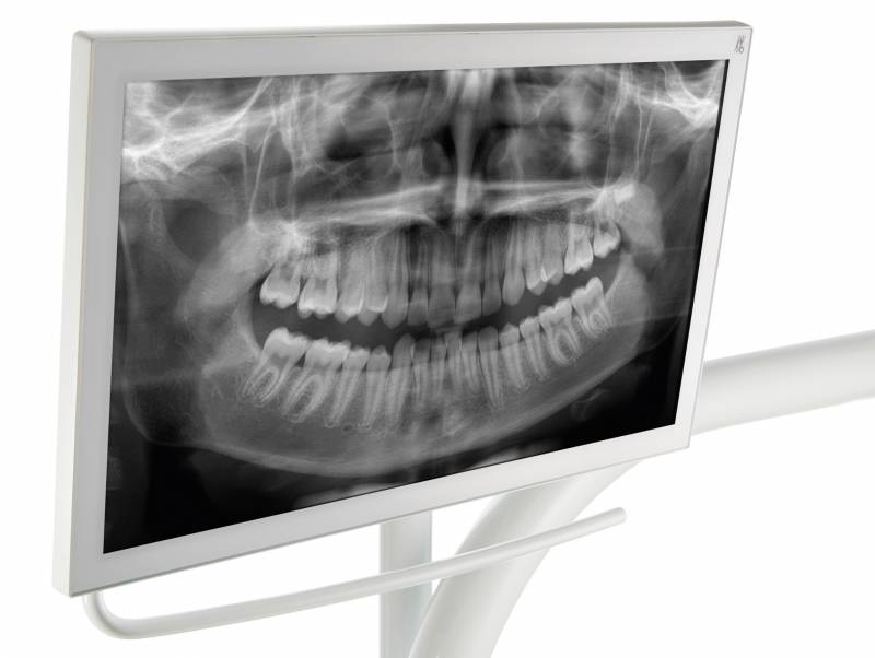 Ecrans KaVo Screen One™️ & Screen HD™️