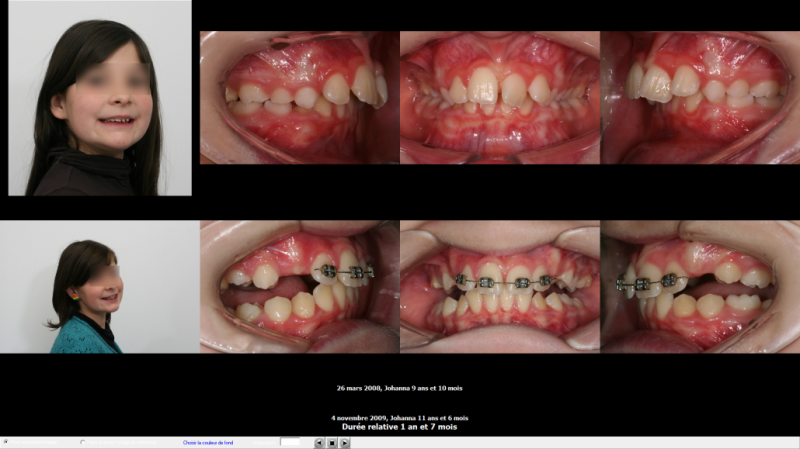 Application KITVIEW, La communication photo au sein du cabinet dentaire et du cabinet d'orthodontie