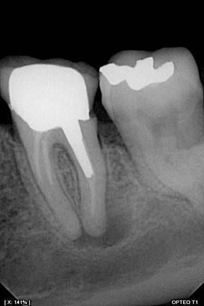 Capteur OWANDY OPTEO, le seul capteur radio parfaitement intégré et piloté dans votre application Julie Software