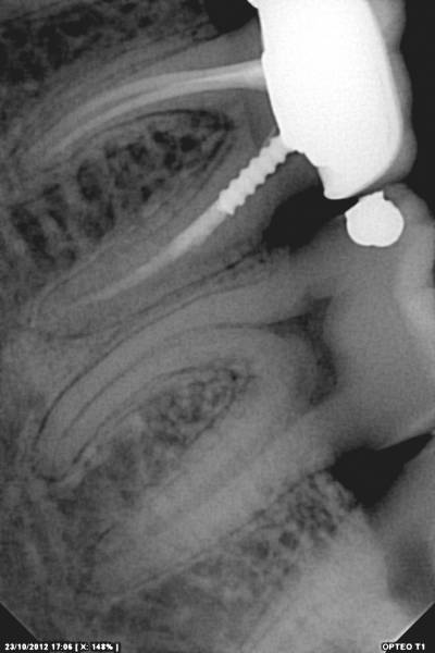 Capteur OWANDY OPTEO, le seul capteur radio parfaitement intégré et piloté dans votre application Julie Software
