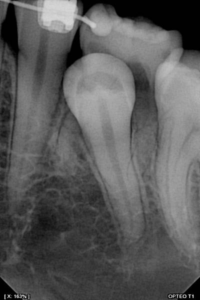 Capteur OWANDY OPTEO, le seul capteur radio parfaitement intégré et piloté dans votre application Julie Software