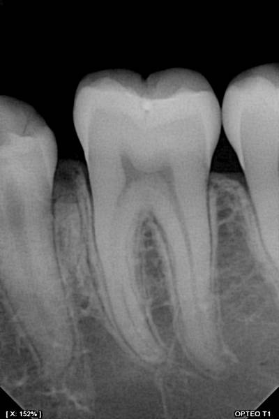 Capteur OWANDY OPTEO, le seul capteur radio parfaitement intégré et piloté dans votre application Julie Software
