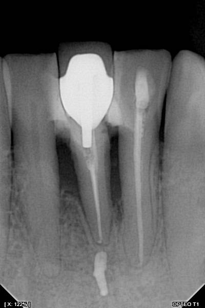 Capteur OWANDY OPTEO, le seul capteur radio parfaitement intégré et piloté dans votre application Julie Software