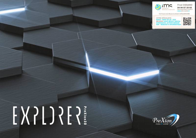 Conebeam PREXION 3D Explorer