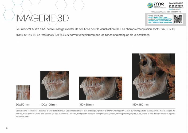 Conebeam PREXION 3D Explorer