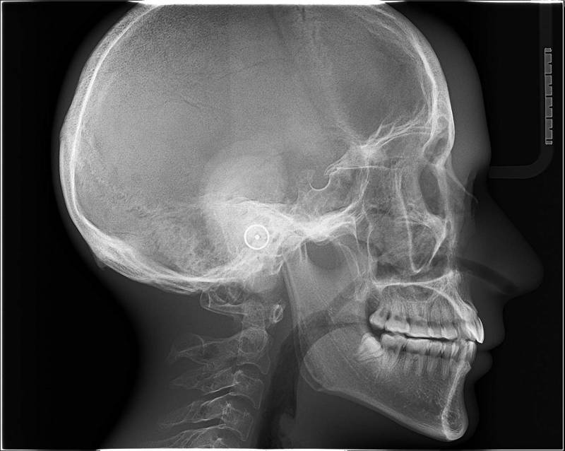 Conebeam OWANDY iMAX 3D Ceph