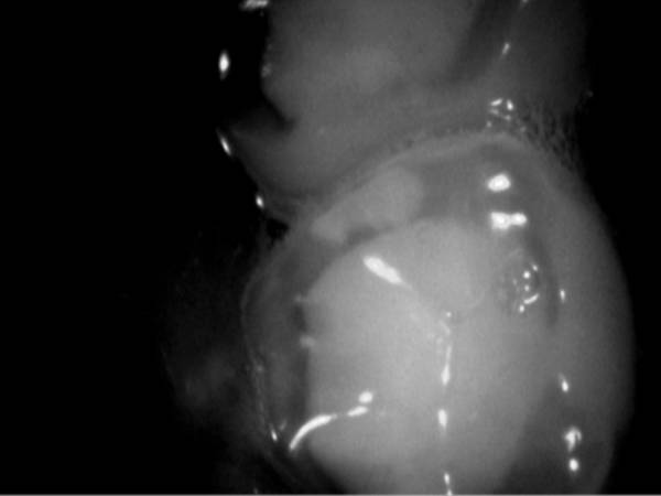 Caméra intraorale DURR DENTAL iX HD Smart