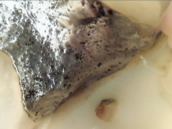 Caméra intraorale DURR DENTAL iX HD Smart