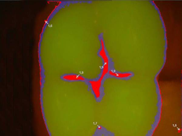 Caméra intraorale DURR DENTAL iX HD Smart