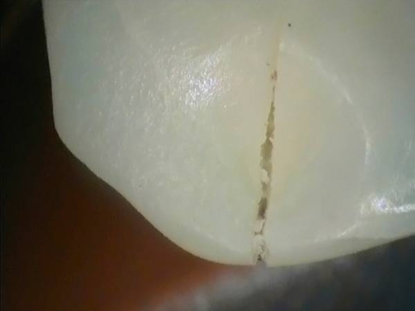 Caméra intraorale DURR DENTAL iX HD Smart