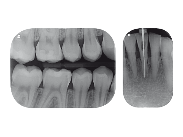 Scanner radiologique DURR DENTAL VISTASCAN Mini Easy