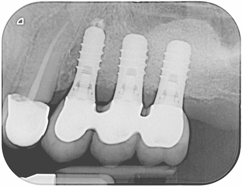 Scanner radiologique DURR DENTAL VISTASCAN Mini Easy
