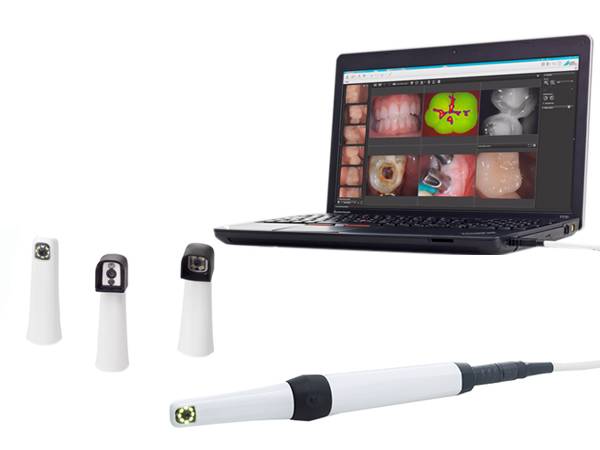 Caméra intraorale DURR DENTAL iX HD Smart
